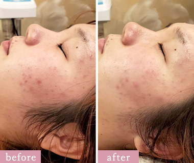 陶肌トリートメント - 津市のプライベートサロン｜MIROKU【公式】