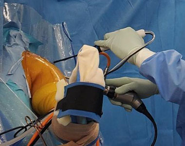 関節鏡手術とは | 肩関節鏡手術の職人 鈴木隆