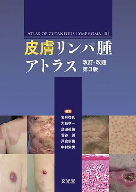 m3電子書籍 | 皮膚リンパ腫アトラス 改訂・改題第3版