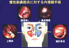 徳島大学 耳鼻咽喉科・頭頸部外科学分野｜耳鼻咽喉科・頭頸部外科の