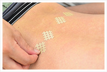 スパイラルテーピング療法 / 施術について | 山陽電鉄高砂駅近くの