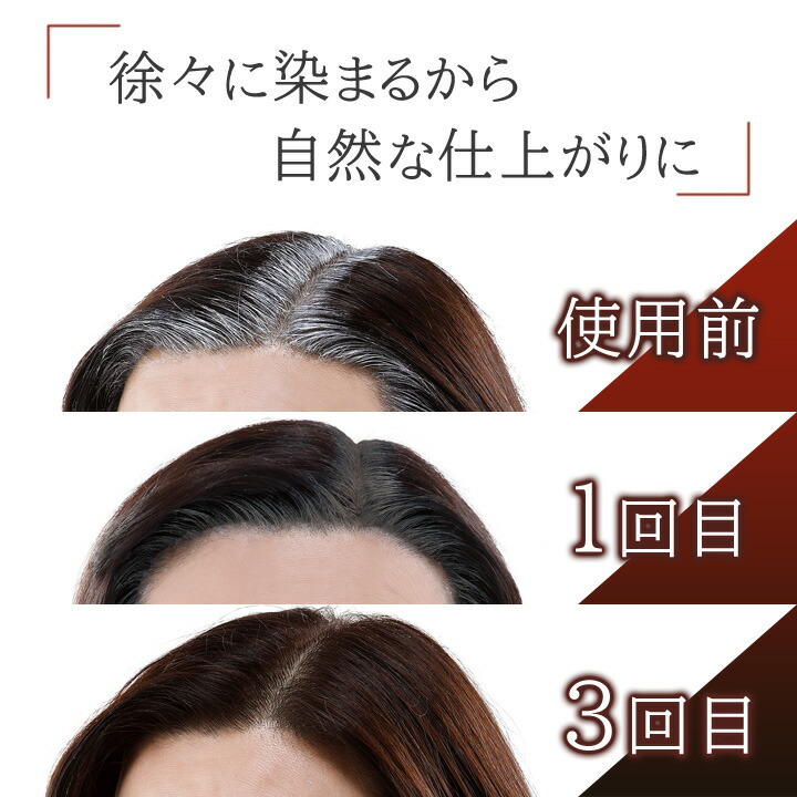 楽天市場】即納☆【在庫限り】ピンポイント白髪染め クイックヤング