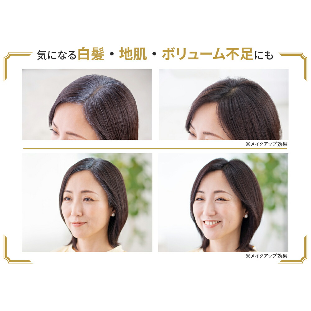 楽天市場】【20%OFFクーポン】 公式 アートネイチャー アートミクロン