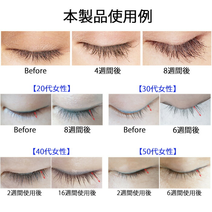 楽天市場】まつげ美容液 エヴォケア アイラッシュ ソリューション