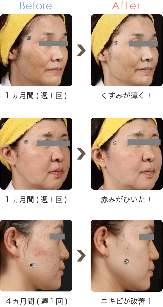 3つのプロセスにより高い美白効果を実現！美白美容液パック+アルギン酸