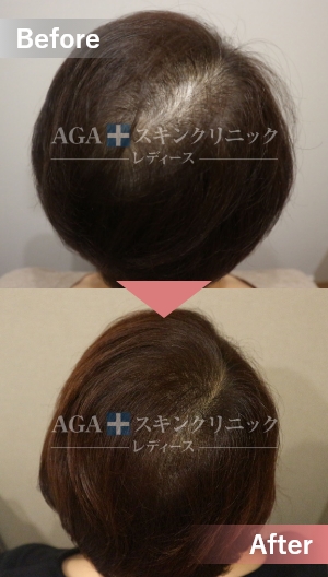名駅錦通院（愛知県） - 女性の薄毛・抜け毛・FAGA治療はAGAスキン