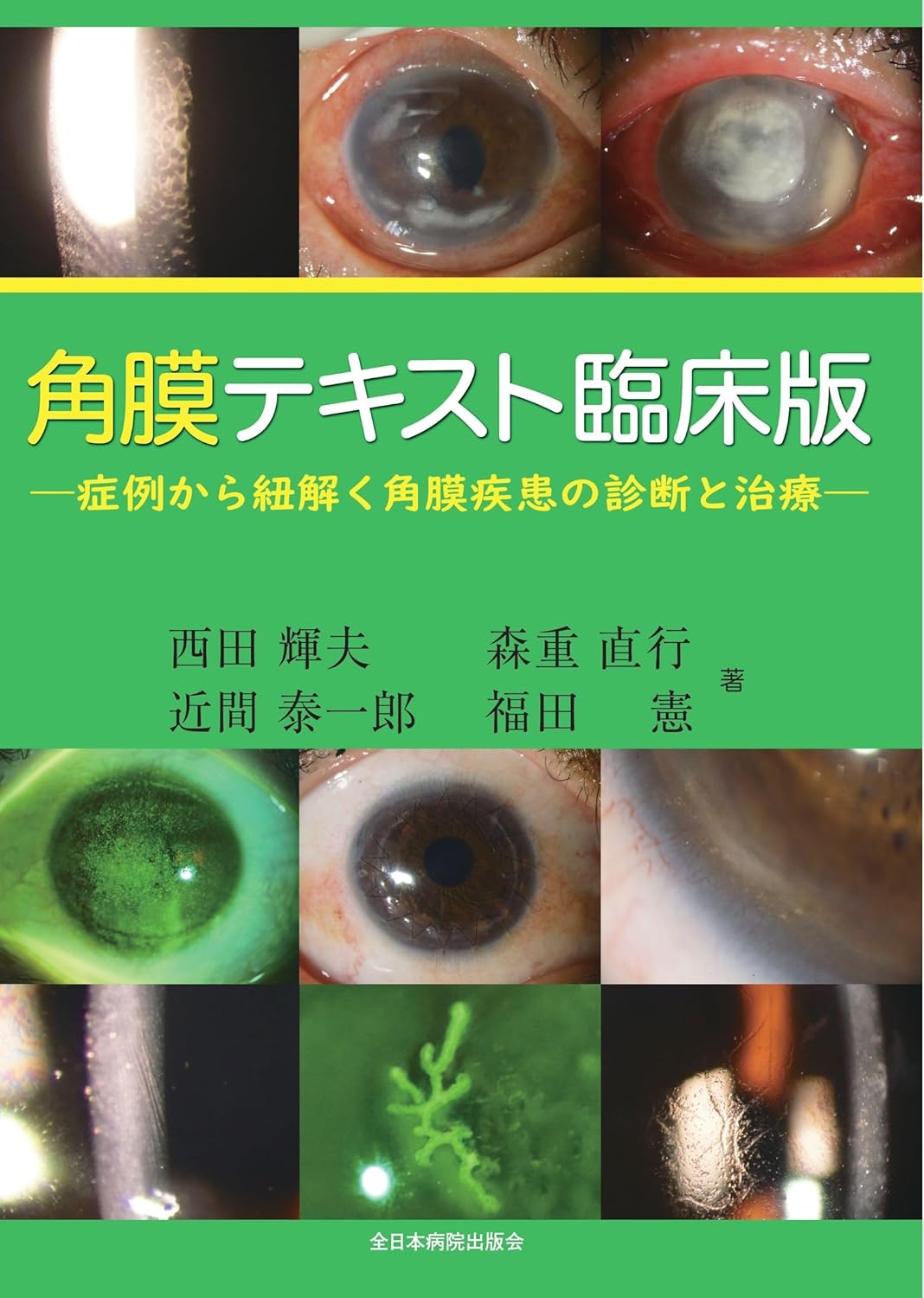 角膜テキスト臨床版―症例から紐解く角膜疾患の診断と治療― - 眼科専門