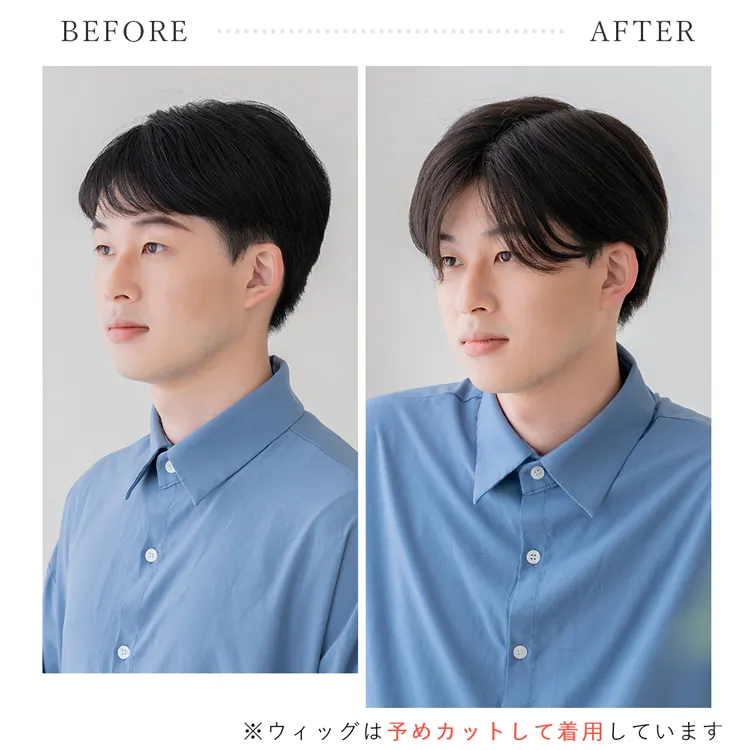 総手植え 最高級レミー人毛100% リアルフィットスキン トップ