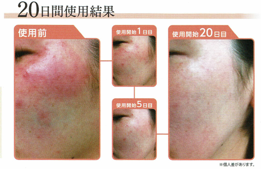 エステルームかれん / major薬用ｸﾘｰﾑ(医療部外品)