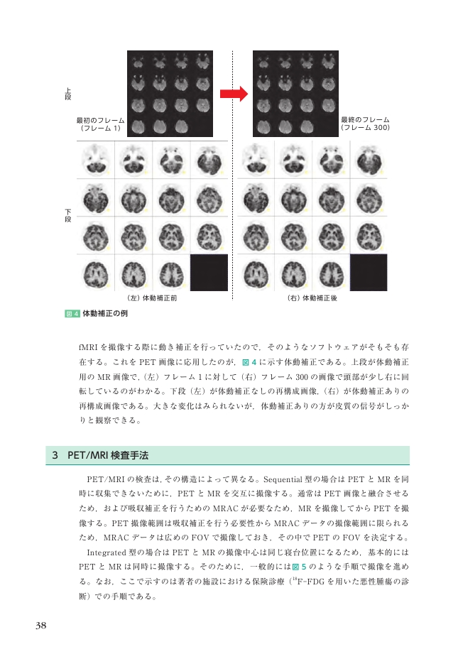 核医学融合画像‐基礎と臨床