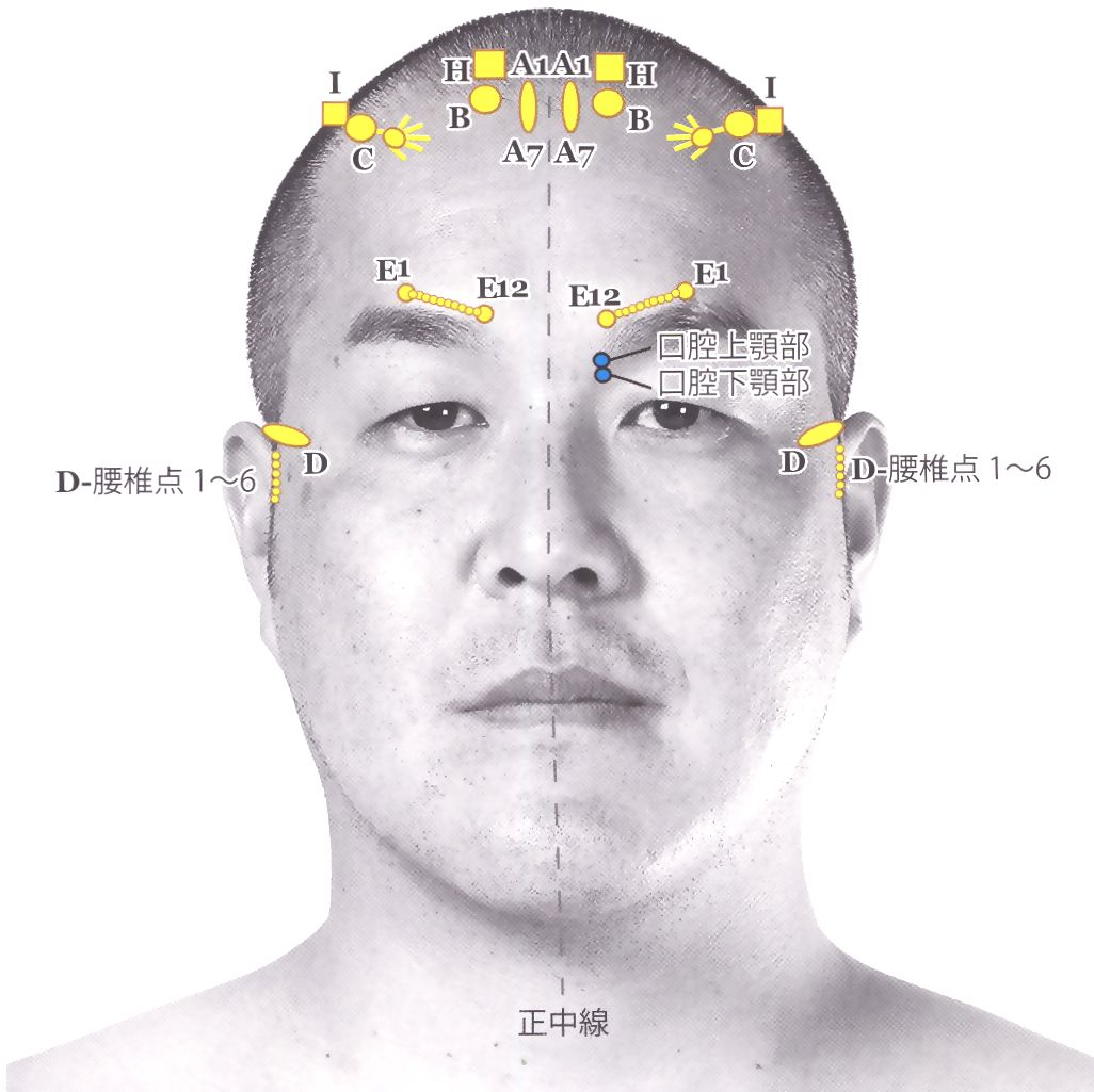 頭鍼・YNSA 山元式新頭鍼療法 三島市のコンディショニングセンター伊豆