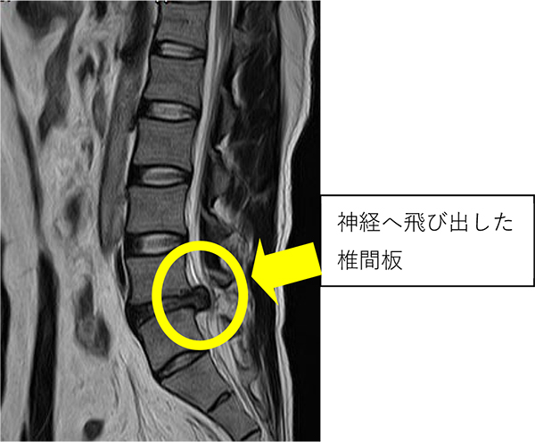 慶友脊椎内視鏡センター | 慶友会