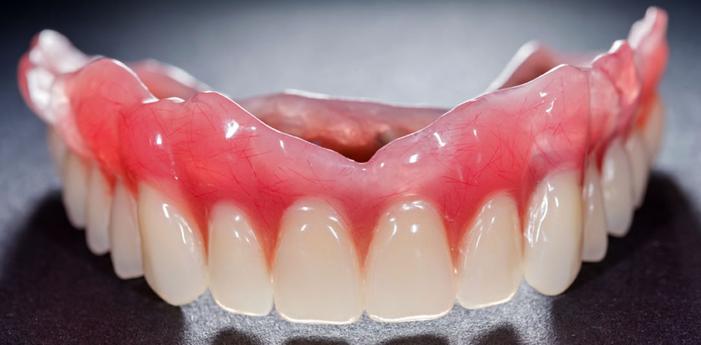 しっかり噛める入れ歯・義歯の製作｜柏駅前の歯医者｜柏KT歯科