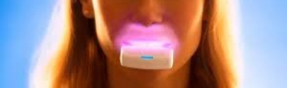 オルソパルス（光加速矯正装置）なら東京銀座ビアンコ矯正歯科