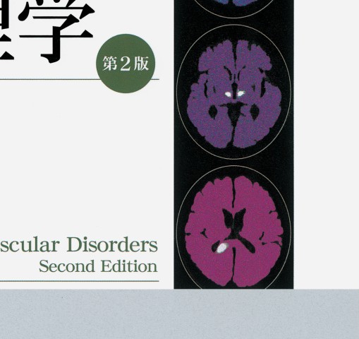 脳血管障害と神経心理学 2E』 立ち読み