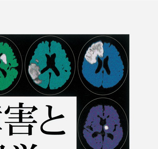 脳血管障害と神経心理学 2E』 立ち読み