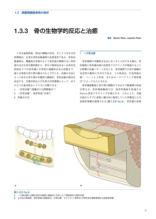 AO法骨折治療 頭蓋顎顔面骨の内固定訳－外傷と顎矯正手術』 立ち読み