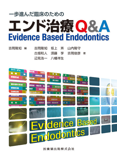 一歩進んだ臨床のための エンド治療Q&A Evidence Based Endodontics