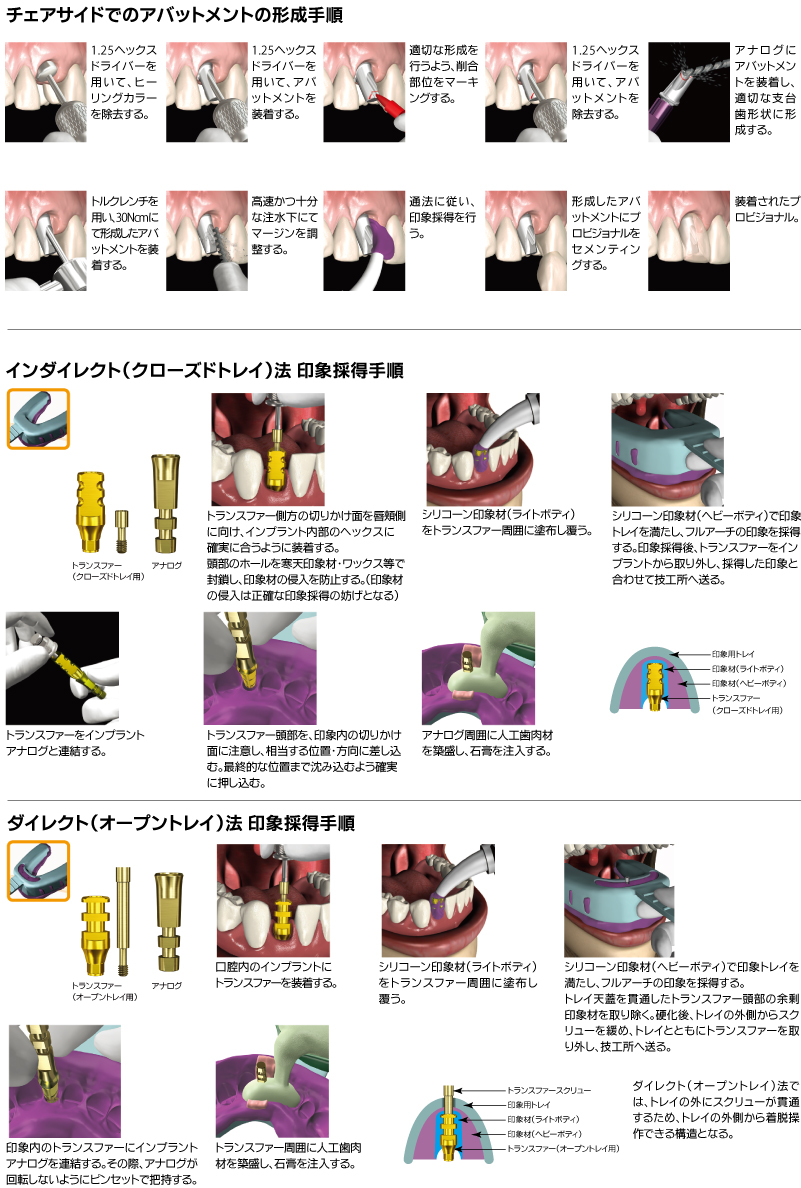 補綴術式マニュアル|株式会社インプラテックス