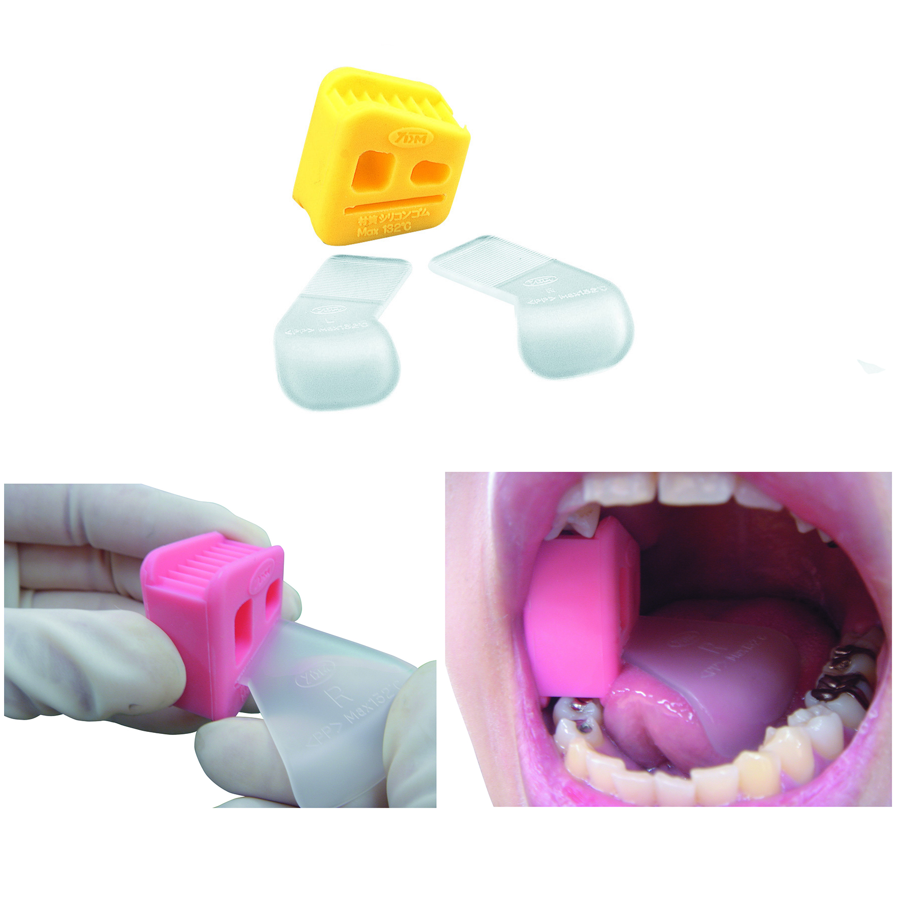 タングガード付 開口器 S｜株式会社インプラテックスの取扱い商品