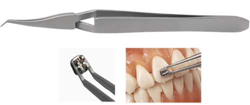ブラケット・チューブのポジショニング／ボンディング | 株式会社 JM Ortho