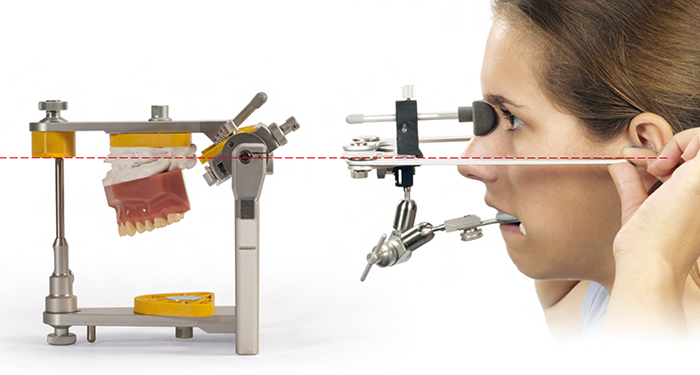 フェイスボウトランスファー(ATB) | 株式会社 JM Ortho