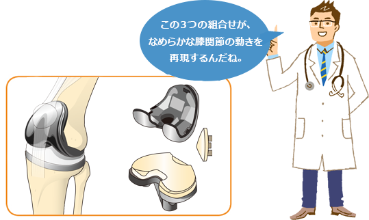人工ひざ関節置換術とは｜人工ひざ関節について｜人工関節ドットコム