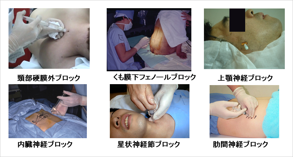 日本ペインクリニック学会