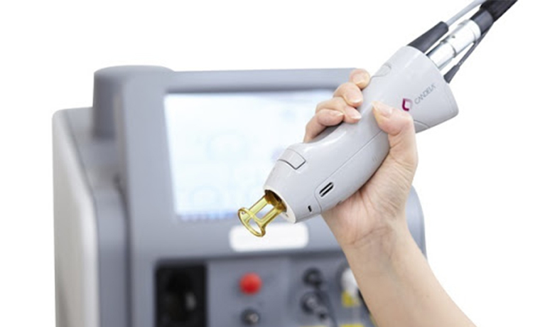 脱毛（GentleMax Pro） | 東京の美容皮膚科・外科 | お茶の水美容形成