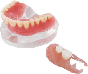 ノンクラスプデンチャー 鹿児島鹿屋市の歯科技工所 デンタルラボ真