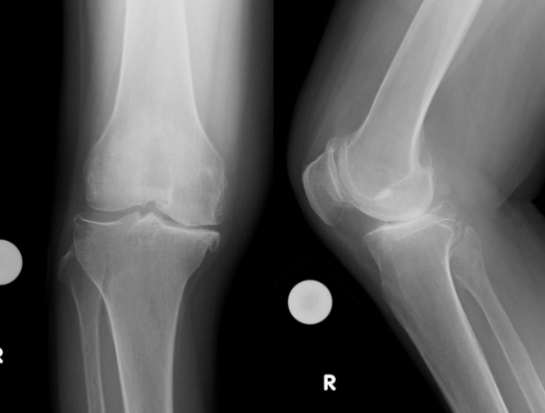 膝関節外科｜日本医科大学付属病院