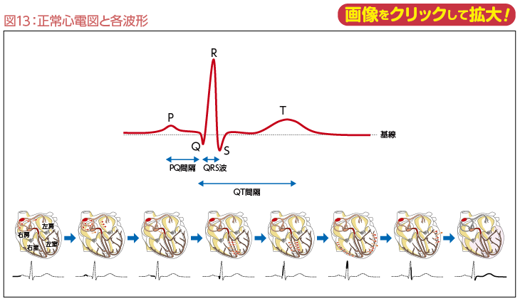 ステップアップで理解する心電図講座【Web解説】