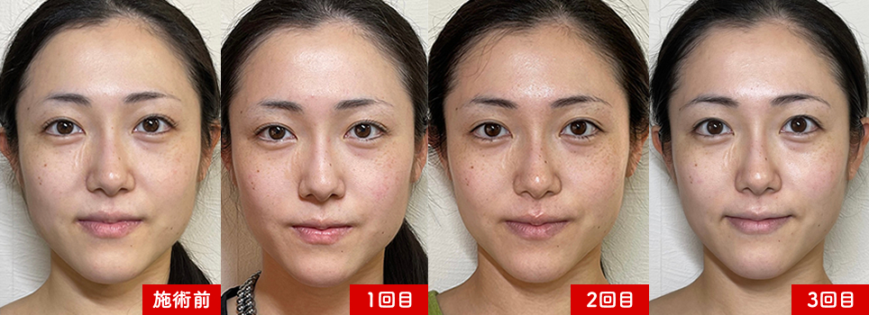 2B Bio Treatment バイオプランタトリートメント – サラマニーシャ