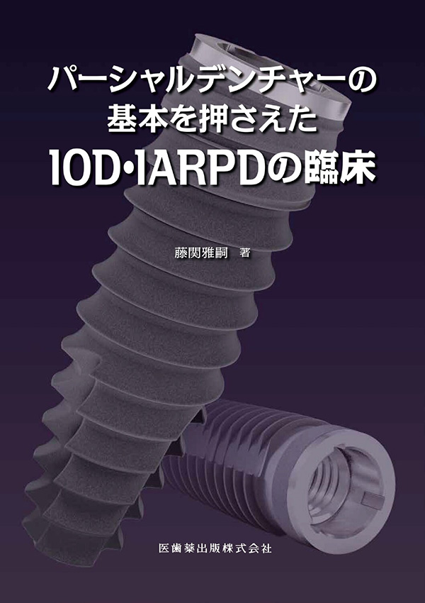パーシャルデンチャーの基本を押さえたIOD・IARPDの臨床 | 【歯科学