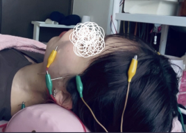 自律神経調整 頑固なコリ掃鍼 ココキュア 院詳細 | 柏・松戸の鍼灸院