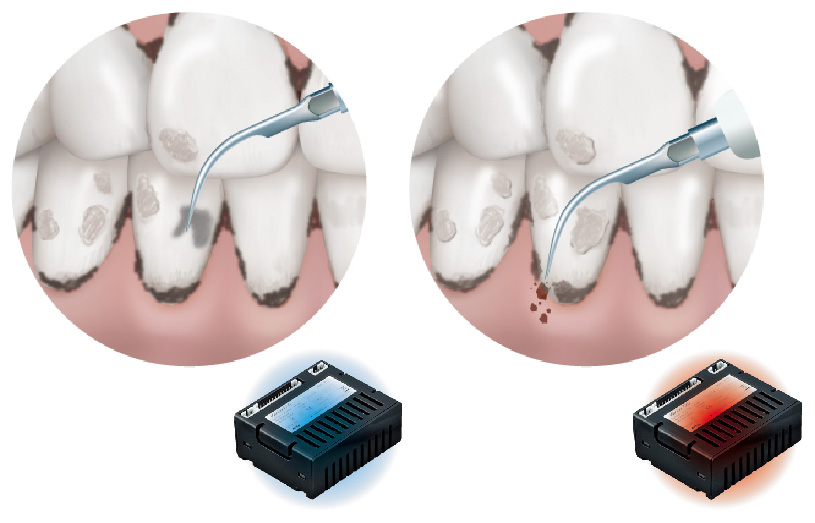 メルサージュ エピック 2in1 | 株式会社 松風