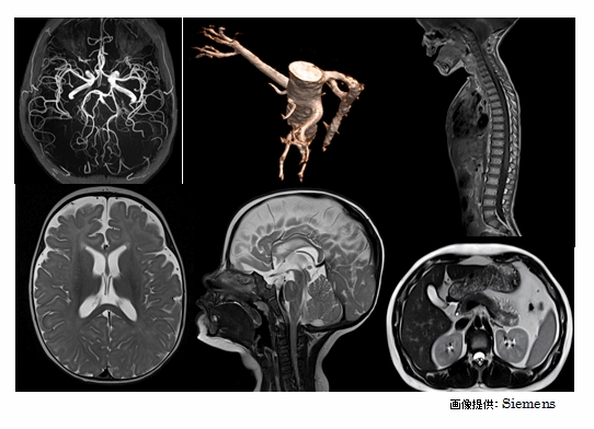 MRI機器紹介③ - 総合病院 土浦協同病院