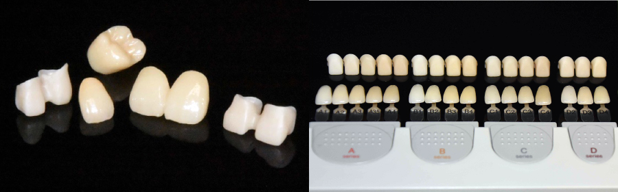 京都の歯科技工所｜ジルコニアフレーム製作なら【ツヤデンタル】