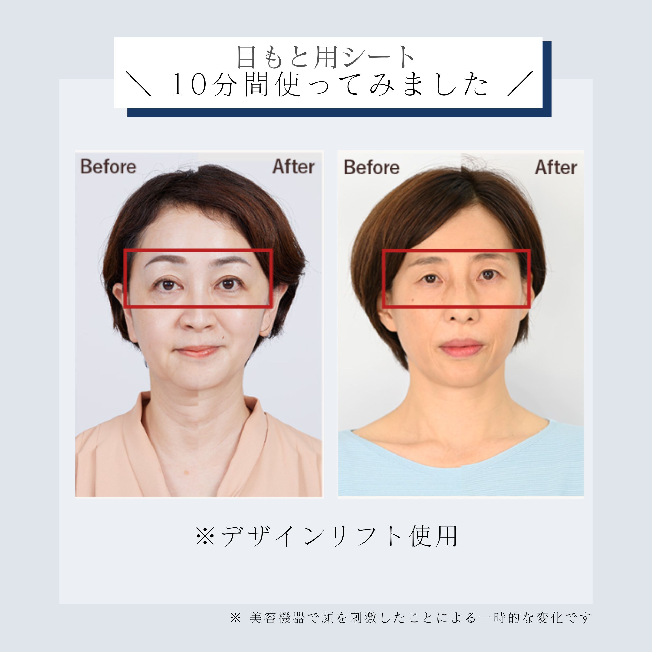 デザインリフトモア目もと集中4ヵ月コースN（C1）｜ヤーマン公式通販