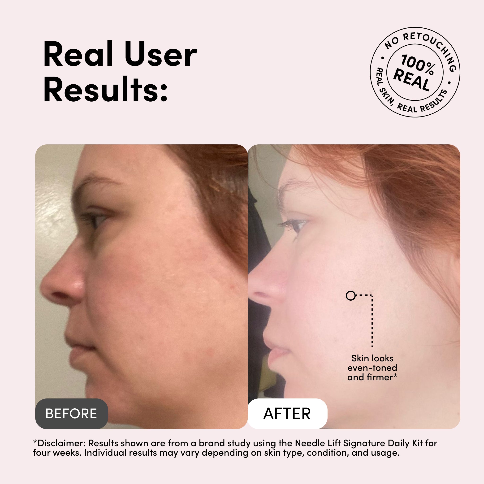 Medi Lift – Needle Lift Signature Daily Kit | Balance, Hydrate