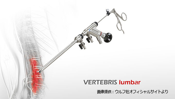 PED・PEL内視鏡脊椎手術(FES手術) – 医療法人平和会 平和病院 横浜脊椎