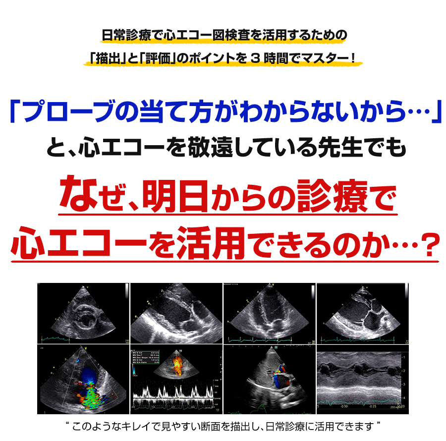 心エコー図検査 描出と評価のコツ | 株式会社 医療情報研究所