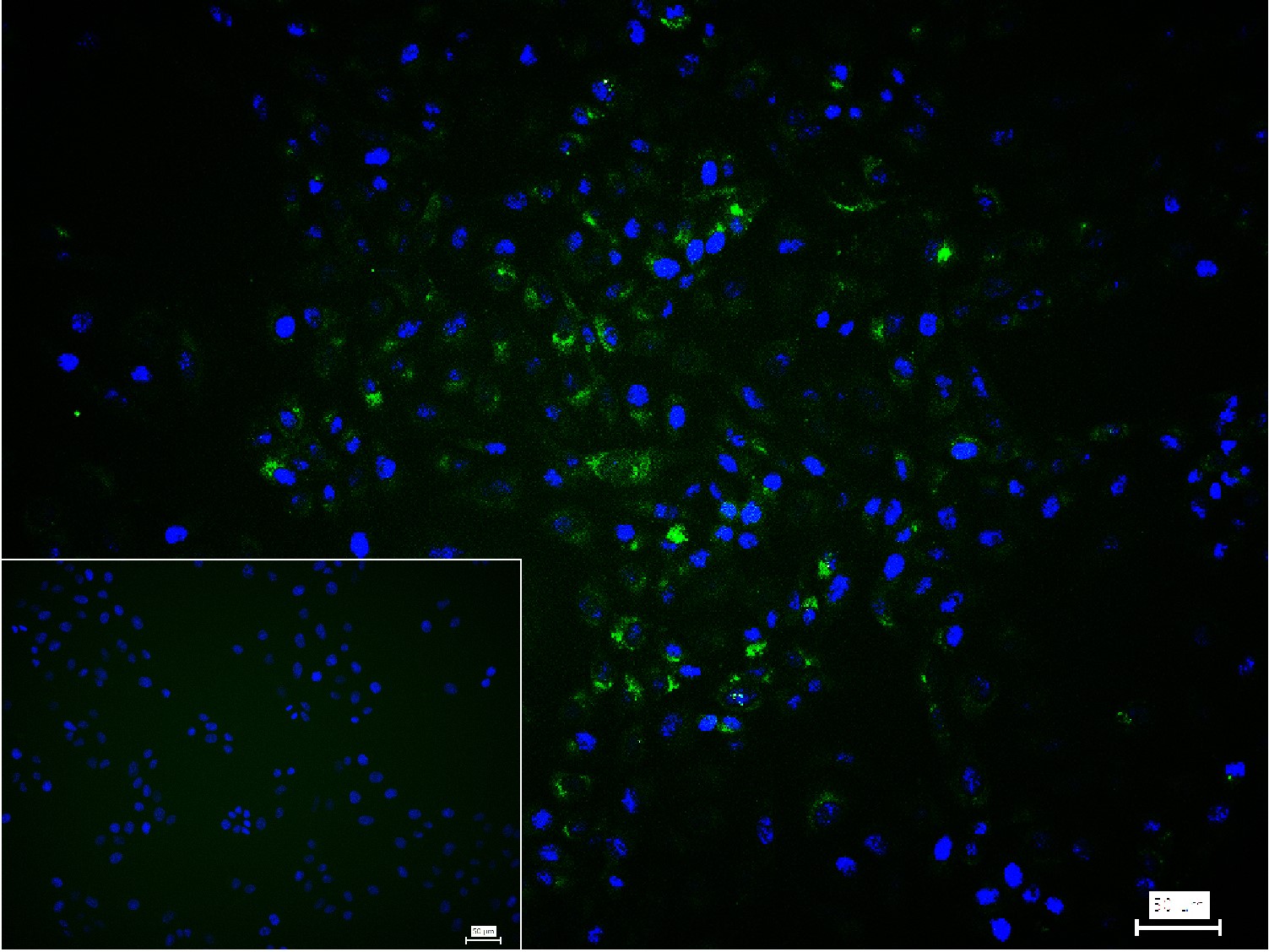 Collagen I Polyclonal Antibody – Bioss
