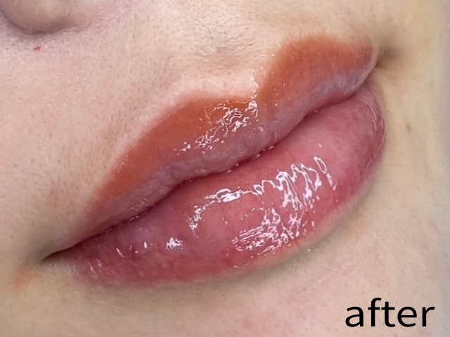 リップアートメイク | 西山歯科医院 港区南麻布