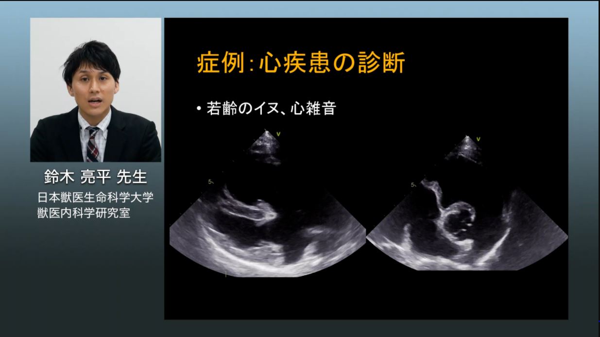 動画 - 心エコー図検査｜ETV Store