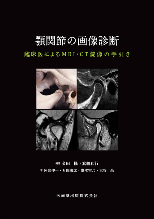 書籍詳細「顎関節の画像診断」 | フォルディネット