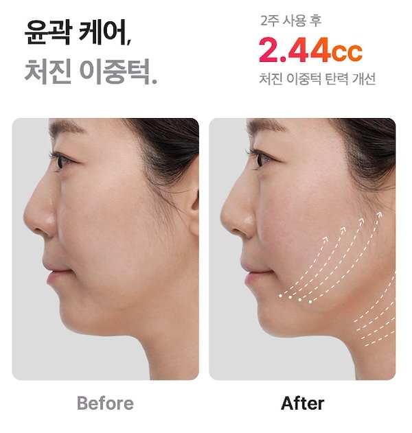 Qoo10] メディキューブ AGE-R ウルトラチューン40.68