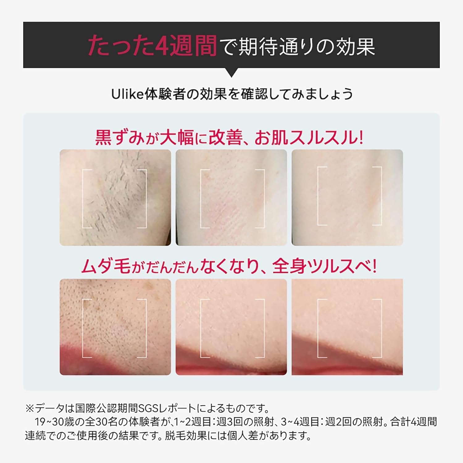 月額5,380円レンタルプラン：Ulike ユーライク 脱毛器 Air Pro UI04CJP