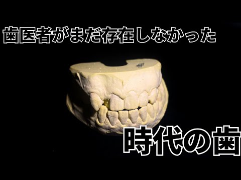 Here are the teeth of an adult man who has been skipping the