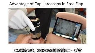 Bscan ZD 作例動画｜血流観察機器を用いた先進的研究動画